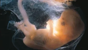 חיים בריא: בעיות לב בעוברים ובתינוקות