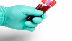 חדשני: בדיקת דם תאתר סרטן ריאות