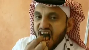 הישרדות גרסת המציאות • אדם אכל 22 עקרבים בעודם חיים