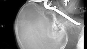 חיים בריא: 20.06.16