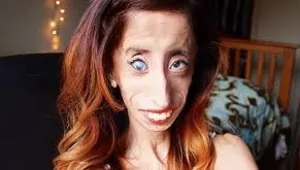 נקמתה של האישה שהוגדרה "האישה המכוערת ביותר בעולם"