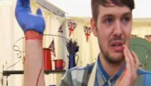 כמעט אסון ריאליטי: מתמודד בתוכנית בישול בריטית חתך את ידו