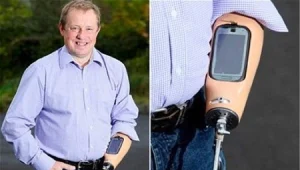 פתרון יצירתי לנכה: יד תותבת שהיא גם תושבת לסמארטפון