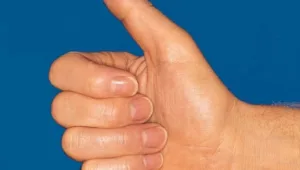 פייסבוק משדרגת את ה"לייק"