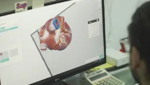 תיעוד: הניתוח המהפכני שבוצע בעזרת מדפסת תלת מימד