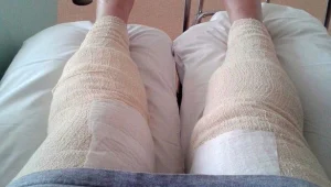 זהירות תמונות קשות: גילחה את המפשעה וכמעט איבדה את חייה