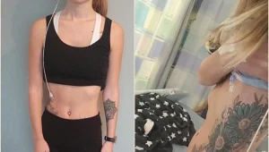 הואשמה באנורקסיה למרות שסבלה ממחלה קשה ולא טופלה במשך שנה