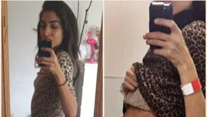 אחרי 10 שנים בהם הסתובבה עם בטן היריון - הרופאים סוף סוף גילו מה יש לה