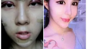 מזעזע: בת 15 עברה עשרות ניתוחים והפכה לכוכבת רשת