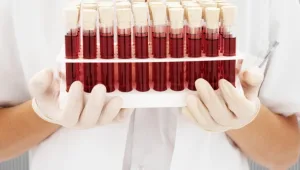 חיים בריא: איך מטפלים בבעיות בקרישת הדם?