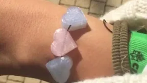 הקיץ בפתח: צמיד מודפס יתריע אם נחשפתם זמן רב לשמש