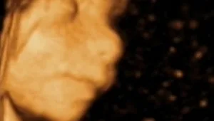 פיתוח ישראלי: הדפיסי את התינוק שלך בתלת מימד