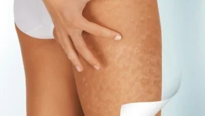 חליפת המסאז' שתסלק את הרעלים מהגוף