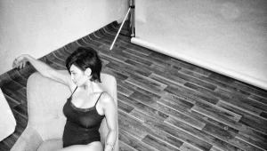 איך מטפלים בסימני מתיחה?