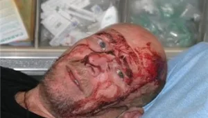 חיילי צה"ל הכו ופצעו בסופ"ש צלם של "אל-חיאת"