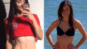 "שנאתי להיות רזה": אכלה צ'יפס, פיצות ועוגות כדי להיראות כך