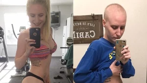 מינוס השרירים והשיער: כוכבת האינסטגרם מתעדת את ניצחון הסרטן