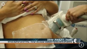 לבחור נכון: כל שרציתם לדעת על הקפאת שומן