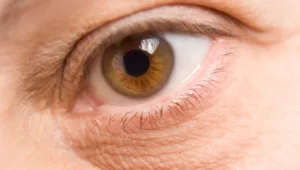 עיניים יפות: ירידה במשקל על פי האירידולוגיה