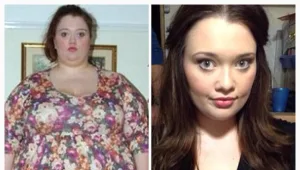 אחרי שהרופאים נתנו לה 6 חודשים לחיות - רזתה והפכה לדוגמנית