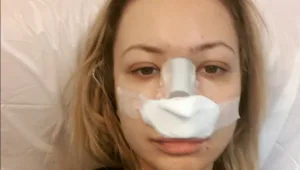 לא תאמינו: מה קרה לפרצוף של אלה?!