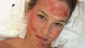 אל אלוהים, מה קרה לפנים של בר רפאלי?