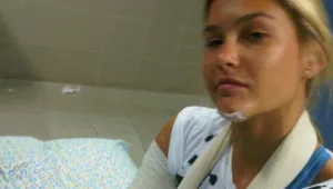 לא משקרת: בר רפאלי אכן שברה את היד!