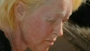 מה קרה לפנים של סינדי לאופר?