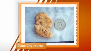 מסר מאלוהים? אישה טוענת שמצאה צ'יקן נאגטס בצורת גורג' וושינגטון