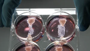 השף הסטון בלומנטל יכין המבורגר שגדל בצלחת מעבדה