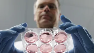 לא עוד פרות - המבורגר שגדל בצלחת מעבדה