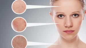 ביוטי בוקס: האפליקציה שתעלים לכם את הפצעונים