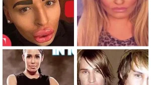 10 אנשים שעשו ניתוחים כדי להיראות כמו הסלבס שהם מעריצים: כמה זה עלה להם, והאם הם דומים למקור?