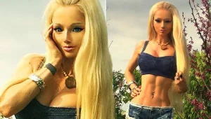 גם אחרי התמונות החדשות: ולריה לוקיאנובה מכחישה את הניתוחים