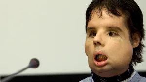 חיים בריא: 13.10.16