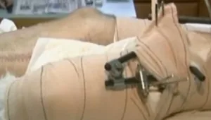 חיים בריא: 22.12.15