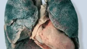 חיים בריא: 10.11.15