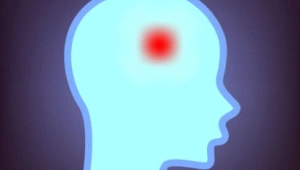 חיים בריא: שבץ ביקיצה