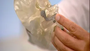 חיים בריא: לא יאומן - שחזור איברים ע"י מדפסת תלת מימד