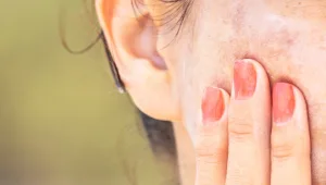 מילון היופי: כך נטפל בכתמי פיגמנטציה