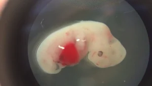 לראשונה: מדענים יצרו עוברים מהכלאה של בני אדם וחזירים