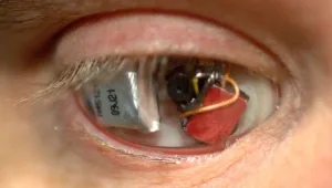 הכירו את האייבורג: האיש שהתקין מצלמה בתוך עיינו