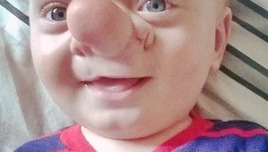 לא זה לא פוטושופ:  "הוא הפינוקיו הקטן שלי",  סיפורו של הפעוט שמרגש את העולם