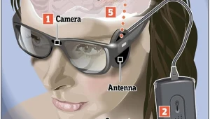 בניתוח מהפכני: עיוורת קיבלה עין ביונית וראתה צורות וצבעים