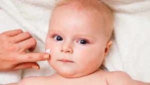 אטופיק דרמטיטיס: הקללה של האביב