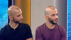 התאומים הזהים התחרשו יחד - וחזרו לשמוע