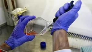 חיים בריא: שיפור המעקב אחר תאי סרטן