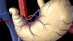 חיים בריא: הנזקים אחרי ניתוח בריאטרי