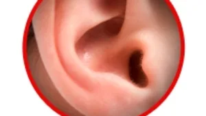 חיים בריא: טיפול בנקב בעור התוף