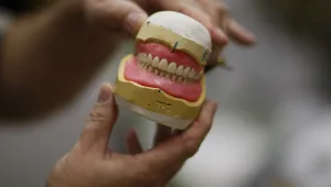 חיים בריא: כיצד מבצעים תיקוני לסת?